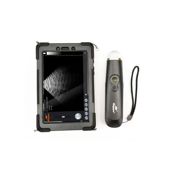 Magascan ultrasound scanner